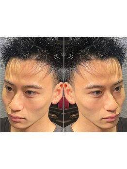 清潔感を大切にした身だしなみサロンで自分磨き！第一印象を変える、メンズのトータルケアサロン◇