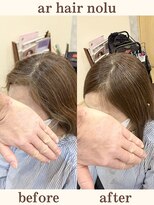 アールヘアノル(ar hair nolu)&nbsp;髪質改善縮毛矯正 15