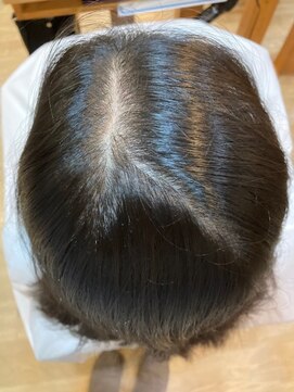 グランバイ アトリエドングリ(Grand × AtlierDonguri) 髪質改善 ビフォーアフター その96