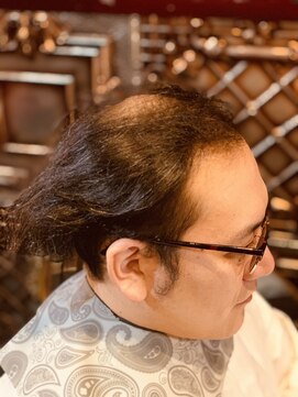 アスイン(asuin) ビフォー