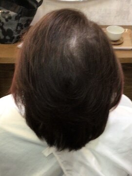 フリーダム(Free Dom) 育毛トリートメント