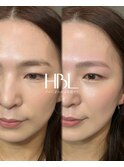 HBL