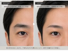 ボルト(BOLT)の雰囲気(【眉ワックス・鼻ワックス】【眉毛矯正】で顔の印象が変わる。)