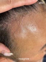 ロハスヘア バイ ノット(rohas hair by knot)&nbsp;ノアグロウスカルプ