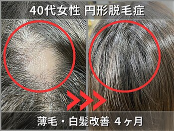 白髪 薄毛 ダメージ 髪質改善美容室 Manoukian Azabudai