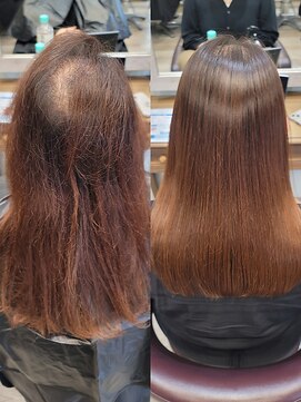 カノアレア by TJ天気予報(Kanoalea) 【ビフォーアフター】髪質改善/高濃度水素ストレート/艶髪カラー