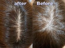シャンスヘアアンドスパ 浦和(CHANCE hair&spa)の雰囲気（ヒト幹細胞培養液で、自ら美容成分を作り出せる肌に導きます）