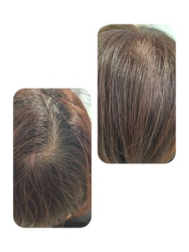 話題のトキカタ♪頭頂部編