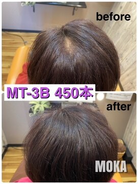 ヘアーサロン モカ(Hair salon MOKA) 増毛エクステ