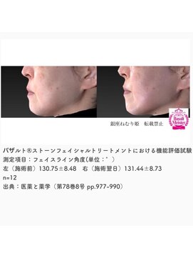 銀座ねむり姫 GINZA east店 エビデンス