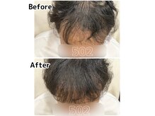 前髪に300本。癖のある髪質にもぴったりなエクステがあります。