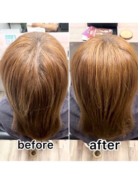 シュガー バイ エクラート 立川南口店(SUGAR by ECLART) 【髪質改善】つむじ割れ改善【立川】