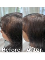 ツムグ 代官山店(TUMUGU)&nbsp;おとな女性の髪悩み/はえ癖解消【ボリュームアップエクステ】