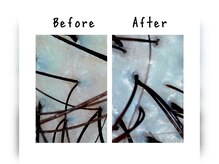 レイル(Reil)の雰囲気(ヘッドスパや頭浸浴をすることで、頭皮改善ができます!)