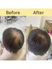 【ツヤと保護】ヘアマニキュア（リタッチ）＋クイックTr　5940円