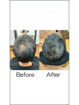 ヘアールームエム(Hair Room M)&nbsp;増毛エクステ