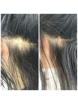 エイジングケア専門店 ジン 美容室(JIN) 【諦めていた抜け毛が改善】 頭皮エステを4回した結果