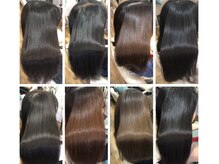 施術後Afterが綺麗なのは当たり前！大切なのは施術後から数ヶ月経過して再来時のBeforeが綺麗なのかが重要