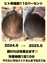 モエちょき&nbsp;ヒト幹細胞110％エアバリ