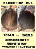 ヒト幹細胞110%エアバリ