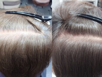 シェーレ(Schere)の写真/《新時代のグレイカラー》種類豊富なカラー剤でキレイな発色/ハリ/コシ/ツヤ/透明感すべてが叶う◇