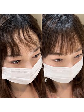 アム 表参道(am) 前髪縮毛矯正【小顔薄めバンググレージュレイヤーロング前髪】