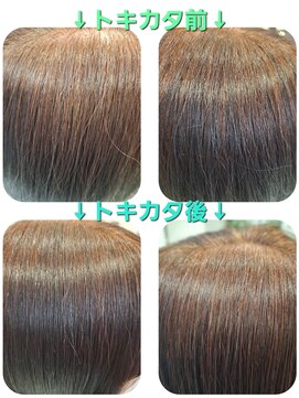 ユーフォルムギンザ(y-Forme Ginza) 話題のトキカタ♪ツヤツヤ滑らか編