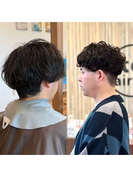 ロトヘアー(Roto hair) お客様Before&After 【Rotohair】
