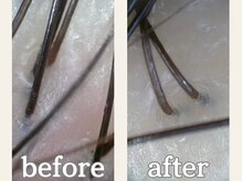 【Before → After】*施術前 施術後の頭皮の状態をチェック*