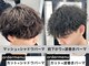 アクロ(ACRO)の写真