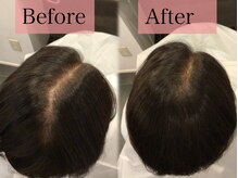 【根本的な改善には継続を】まずは半年～１年続けていきましょう。