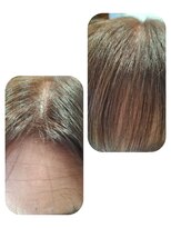 ユーフォルムギンザ(y-Forme Ginza)&nbsp;話題のトキカタ♪前髪編