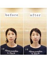 ことりの村&nbsp;骨格補正スパ