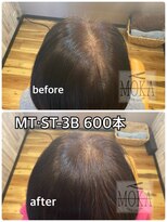 ヘアーサロン モカ(Hair salon MOKA) 増毛エクステ