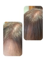 ユーフォルムギンザ(y-Forme Ginza)&nbsp;話題のトキカタ♪前髪編