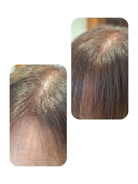 ユーフォルムギンザ(y-Forme Ginza) 話題のトキカタ♪前髪編