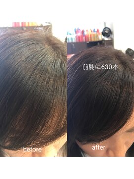 ブロッサム 富士見市 みずほ台(Blossom) 前髪を増やす　富士見市　みずほ台　ヘアループ　630本