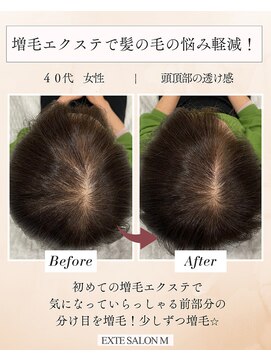エクステサロンエム(EXTE SALON M) 前髪エクステ/増毛エクステ/エアエク/ヘアループ