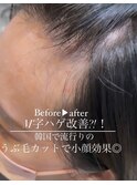 M字がなくなる？！小かお効果UP☆韓国で大人気うぶ毛カット