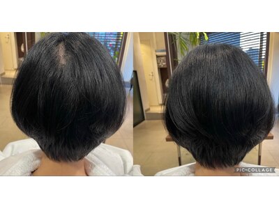 新技術！ヘアリセッター。毛髪交差を取る事が出来ます♪