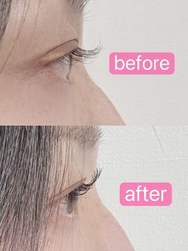 アローズ(arose) まつげパーマ