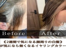 ルクス(Lux)の雰囲気(《顔周りの白髪が2週間で気になる》ならオススメな施術◎)