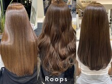 ループス(Roops)