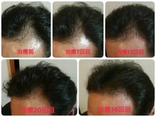 バーバーサンハチ(BARBER 38)の雰囲気（幹細胞上清液の施術！【メンズカット/ヘッドスパ/幹細胞/髪育】 ）