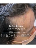 額のM字がなくなる？！小かお効果UP☆韓国で大人気うぶ毛カット