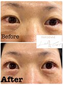 短め、くせ毛アイラッシュリフト『パリジェンヌ』(まつ毛パーマ)