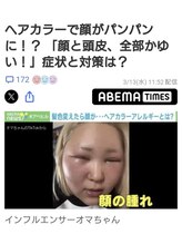 【最新技術】ジアミンが合わない方の負担の軽減