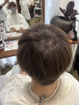 アローズ(arose) つ.むじ増.毛