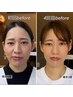【チケット】骨格補正スパ(回数券)＋頭身浴　　￥1650