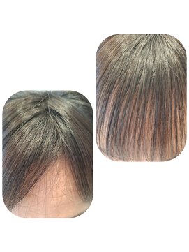 ユーフォルムギンザ(y-Forme Ginza) 話題のトキカタ♪前髪編